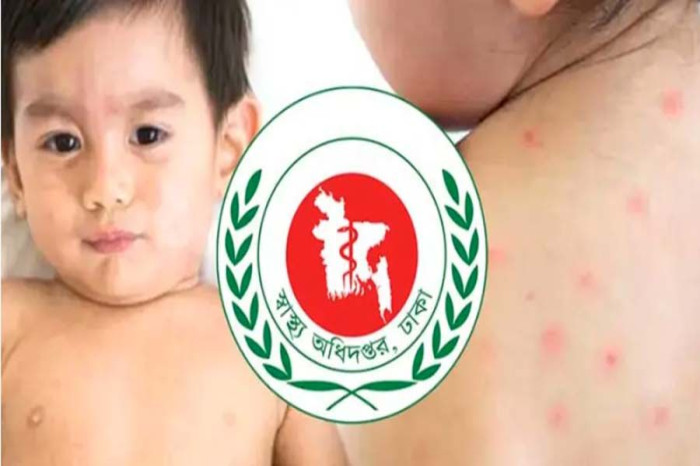 হামের উপসর্গ নিয়ে আরও ৫ জনের মৃত্যু